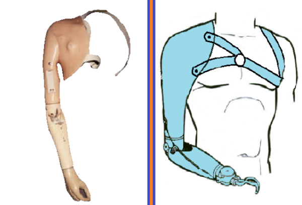 PROTESIS DESARTICULADO DE HOMBRO